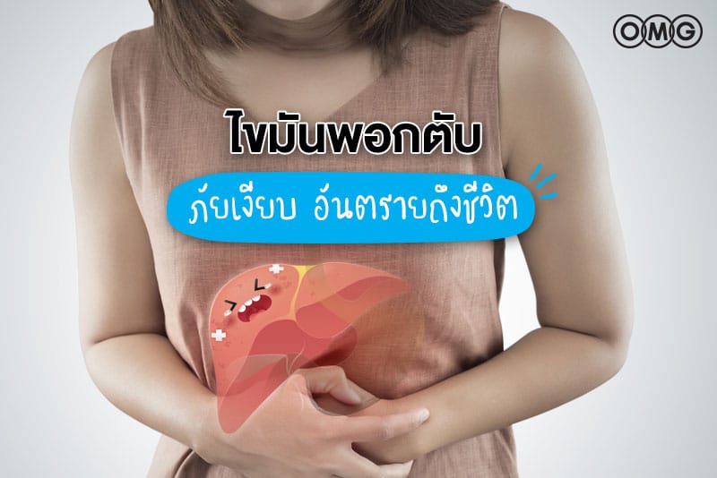 ทำความรู้จัก “ไขมันพอกตับ” ปัญหาที่คนไทยพบมากที่สุดในโลก